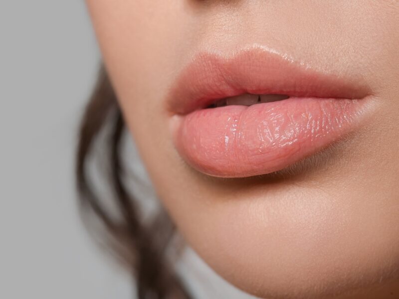 Woman with lip fillers posing close up