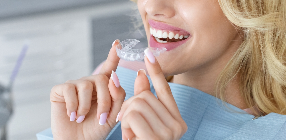 Invisalign braces